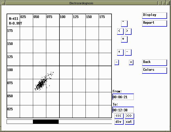 Poincare diagram screen